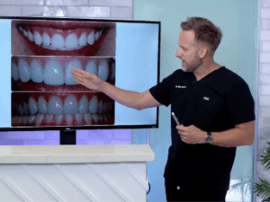 master class smile design secret